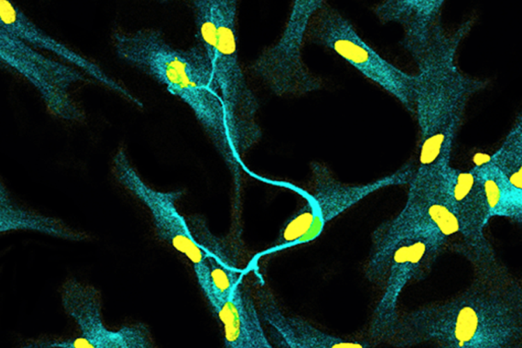 microscopic image of human neuron with astrocytes; yellow and green pattern