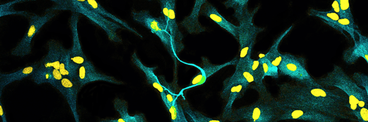 microscopic image of human neuron with astrocytes; yellow and green pattern